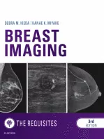 Breast Imaging